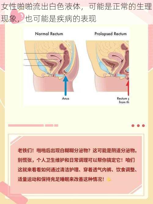 女性啪啪流出白色液体，可能是正常的生理现象，也可能是疾病的表现